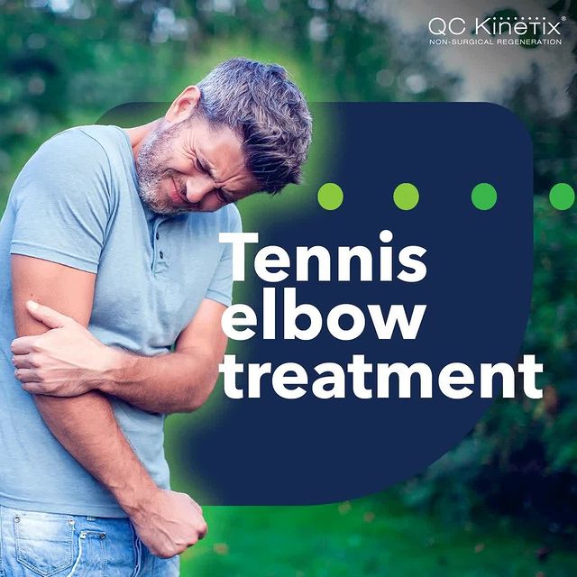 Instagram post: Have you been experiencing tennis elbow? Although relatively common, tennis elbow (lateral epicondylitis), can be a painful condition tha...
